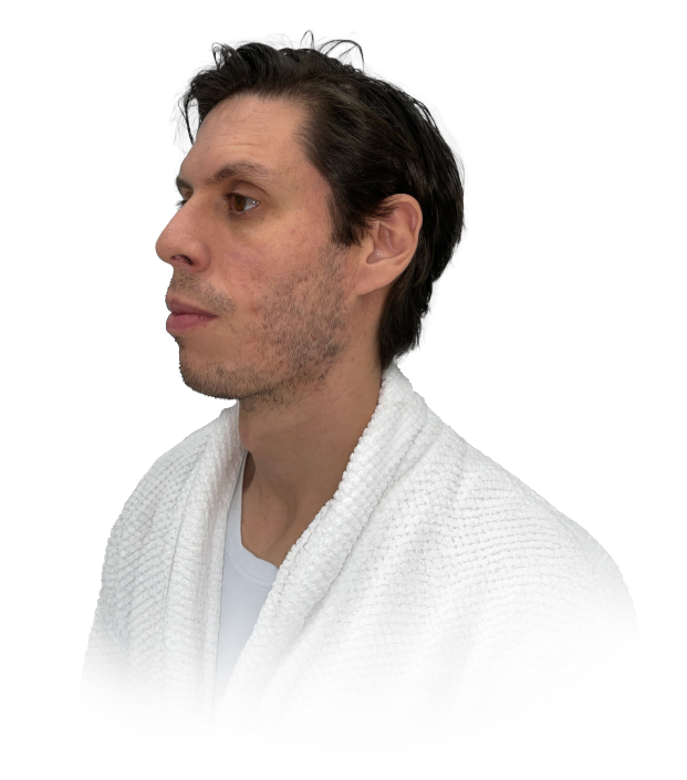 Collagen rebuild