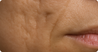 Boxcar Scars