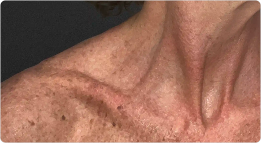 Sun Damage