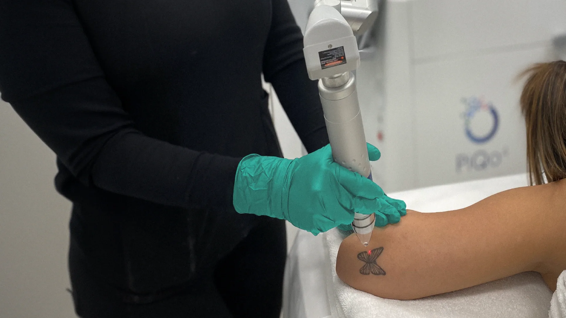 Laser Tattoo Removal at Perfect B