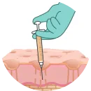 Injectables