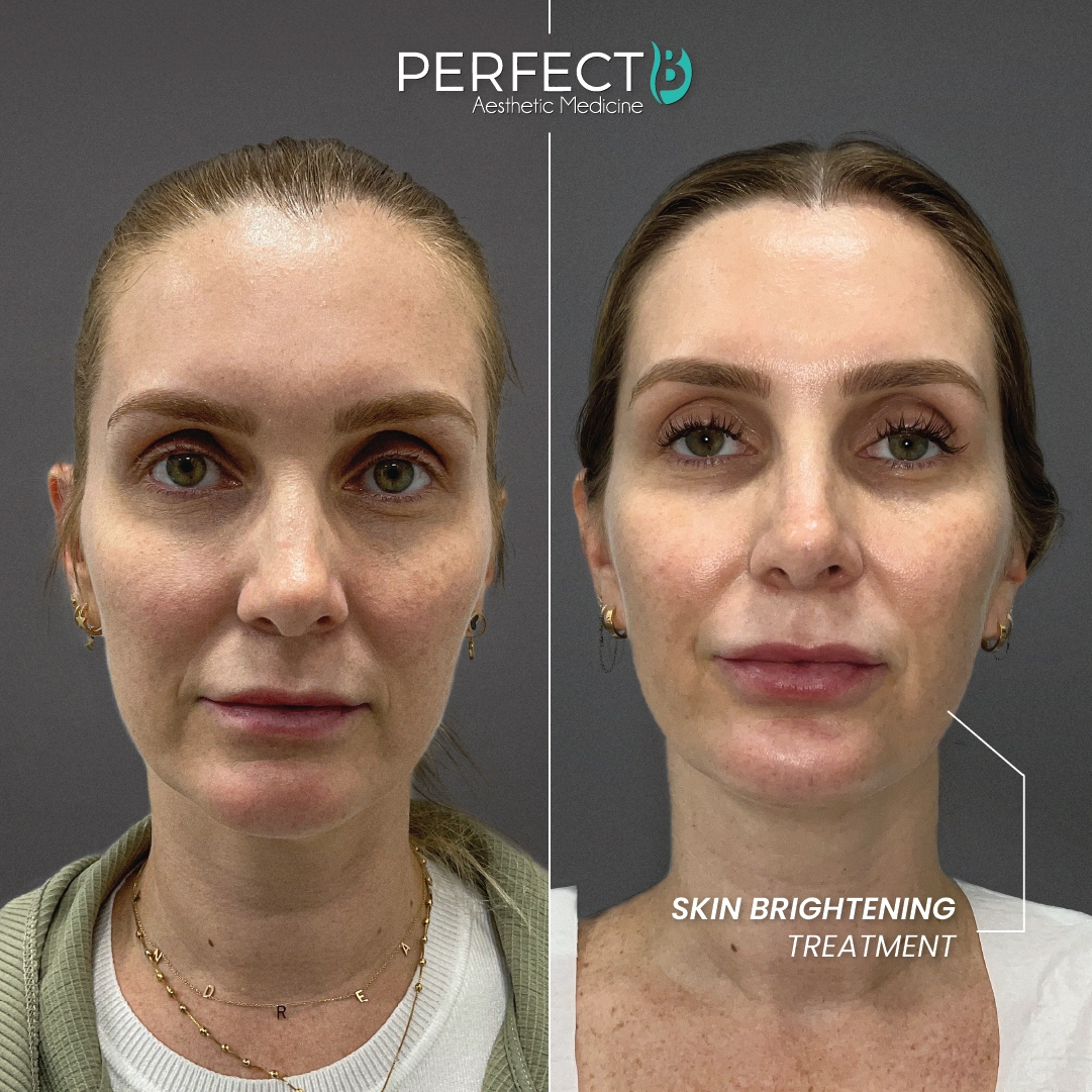 Perfect B result case 3