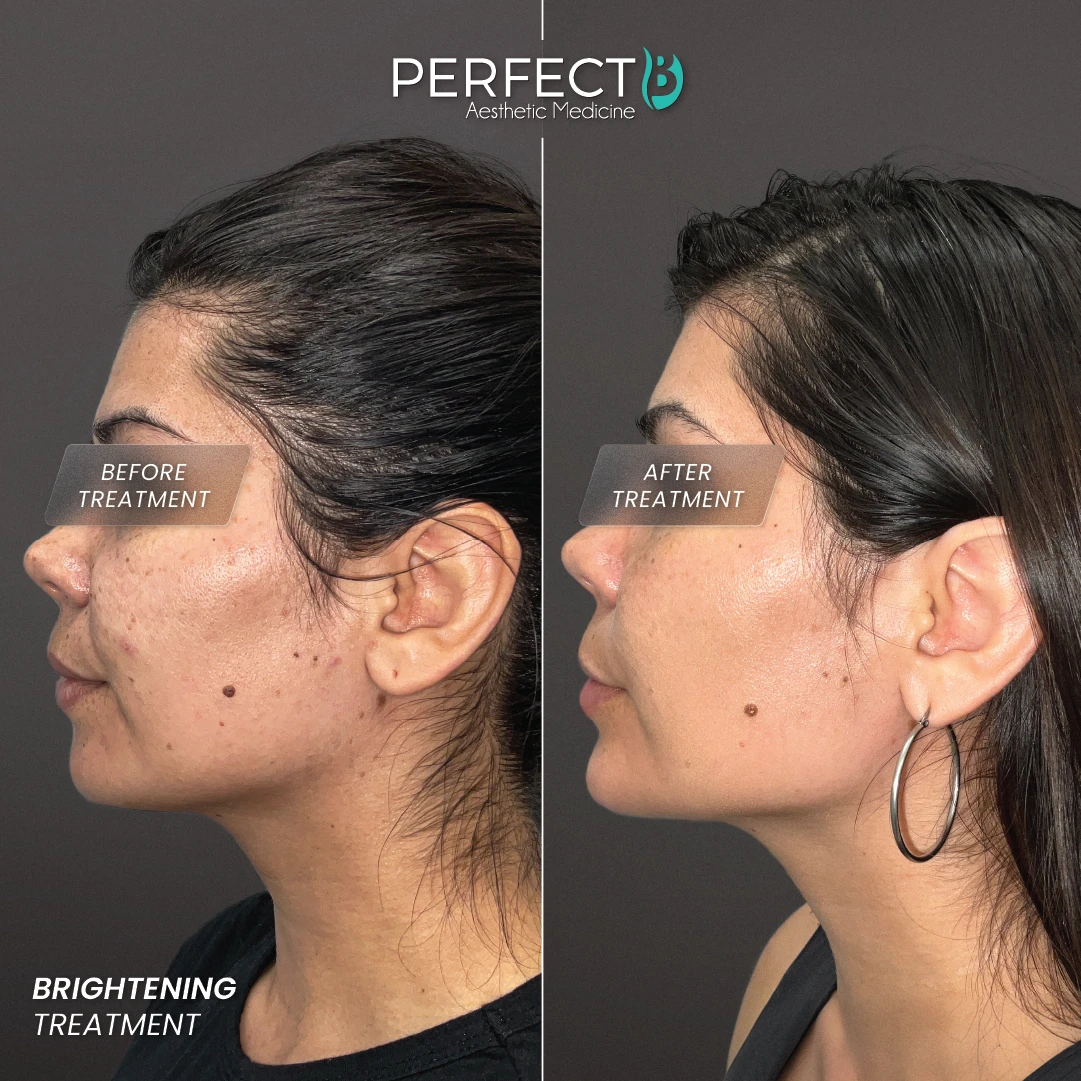 Perfect B result case 5