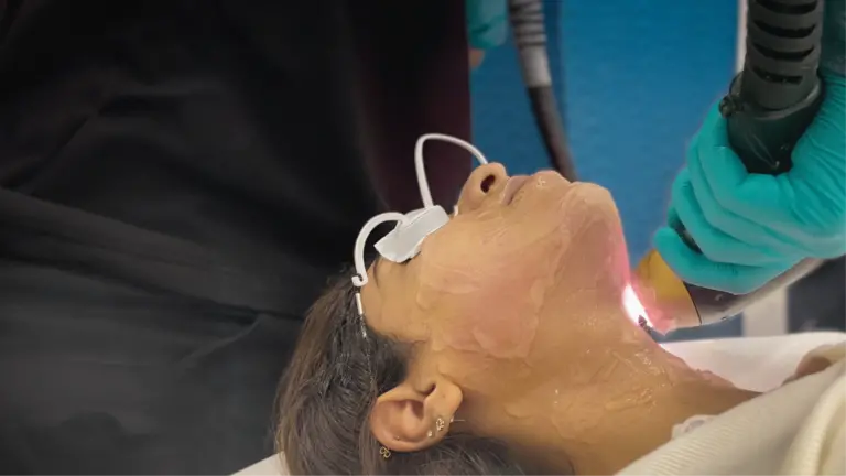 Laser Hair Removal Treatment - Perfect B - Featured Image