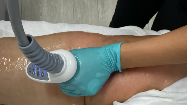 Perfect-B-Cellulite-Reduction-Treatment-Featured-Image