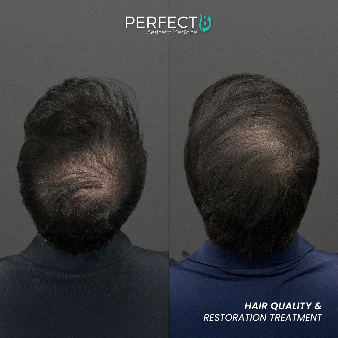 Perfect B - Results Image - [Hair Quality Restoration] 4002 - 1080 x 1080