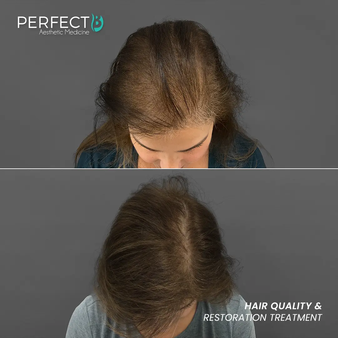 Perfect B - Results Image - [Hair Quality Restoration] Case 6401 - 1080 x 1080