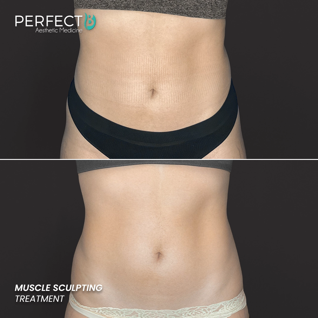 Perfect B - Results Image - [Muscle Sculpting] 4002 - 1080 x 1080
