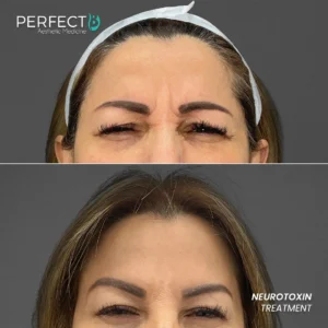 Perfect B - Results Image - [Neurotoxin] 4007 - 1080 x 1080