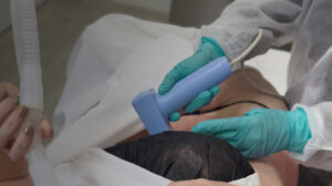 Skin Tightening Treatment - Perfect B - Featured Image