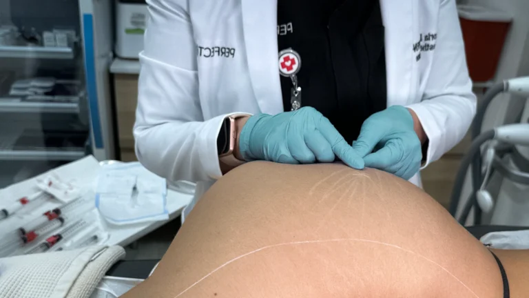 Perfect-B-Glute-Balancing-Treatment-Featured-Image