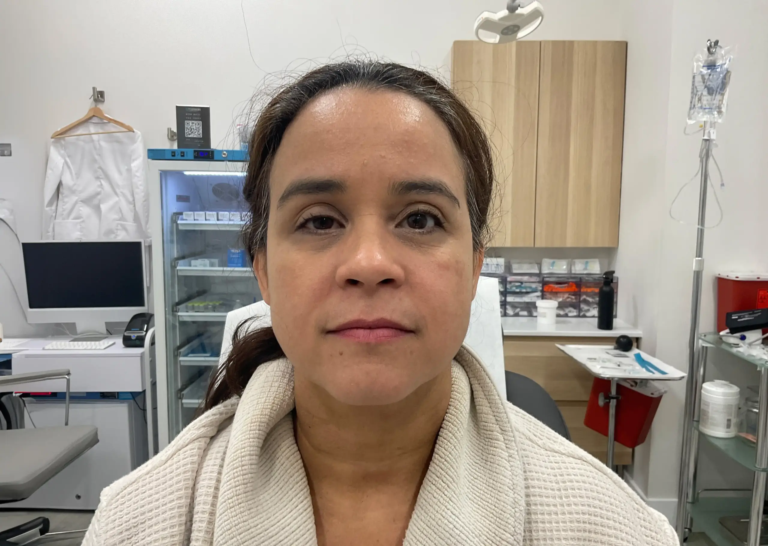 Upneeq before and after