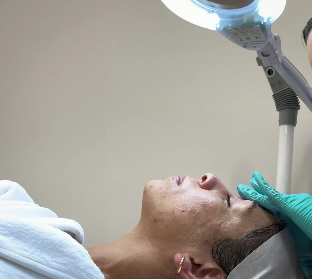 How to get rid of a pimple fast, monthly facials, pimple patches, benzoyl peroxide.