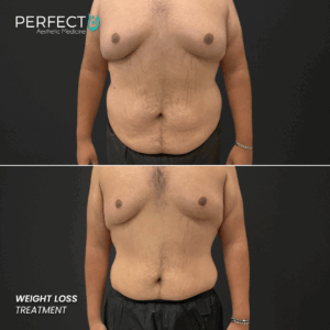 Perfect B - Results Image - [Weight Loss] 4004 - 1080 x 1080