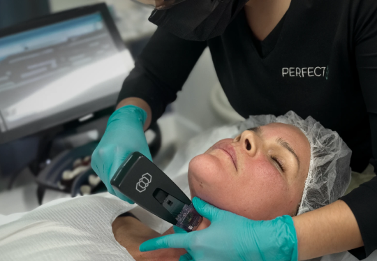 Perfect B_skin_tightening_treatment - morpheus8 - Doral Fl