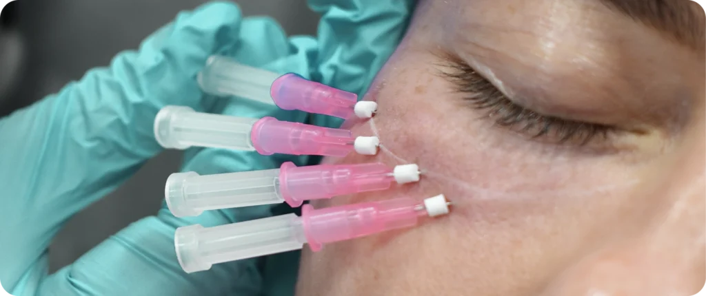Can Botox give you a headache - image text