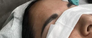 Perfect B - Blogs - laser tattoo removal eyebrows - Hero Portrait