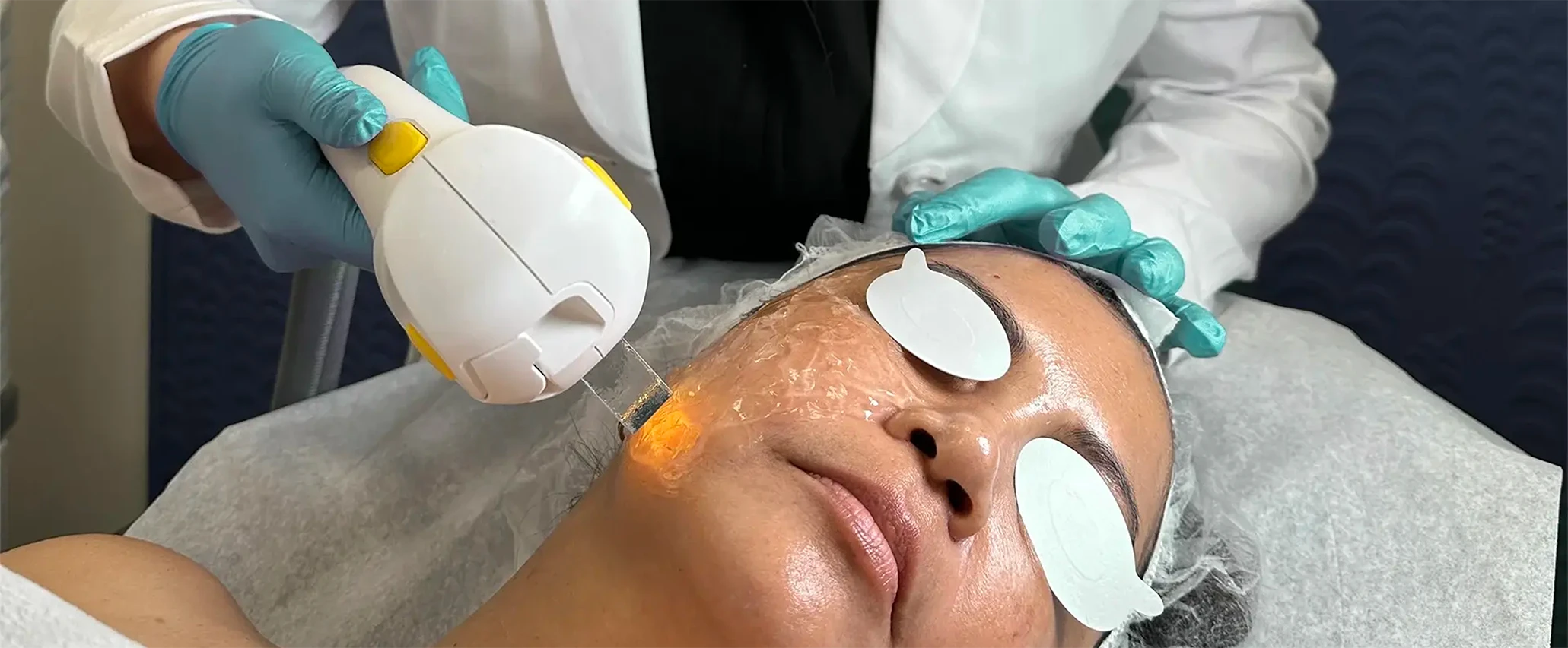 Perfect B - Blogs - Skin treatment with laser - Hero Portrait