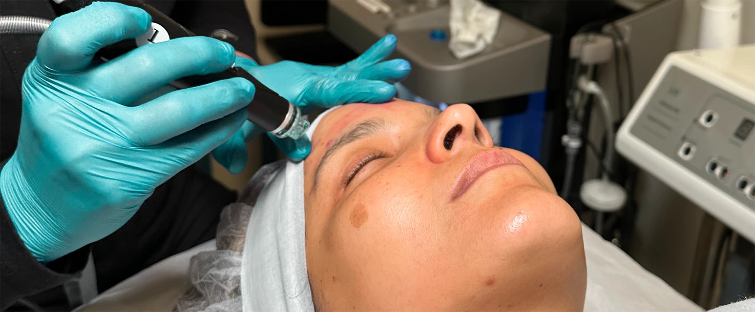 Perfect B - Blog - Skin Brightening Treatment - Image 1