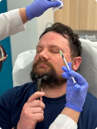 Perfect B - Neurotoxin Treatment - gallery - injection Botox patient