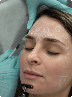 Perfect B - Neurotoxin Treatment - gallery - injection Botox patient