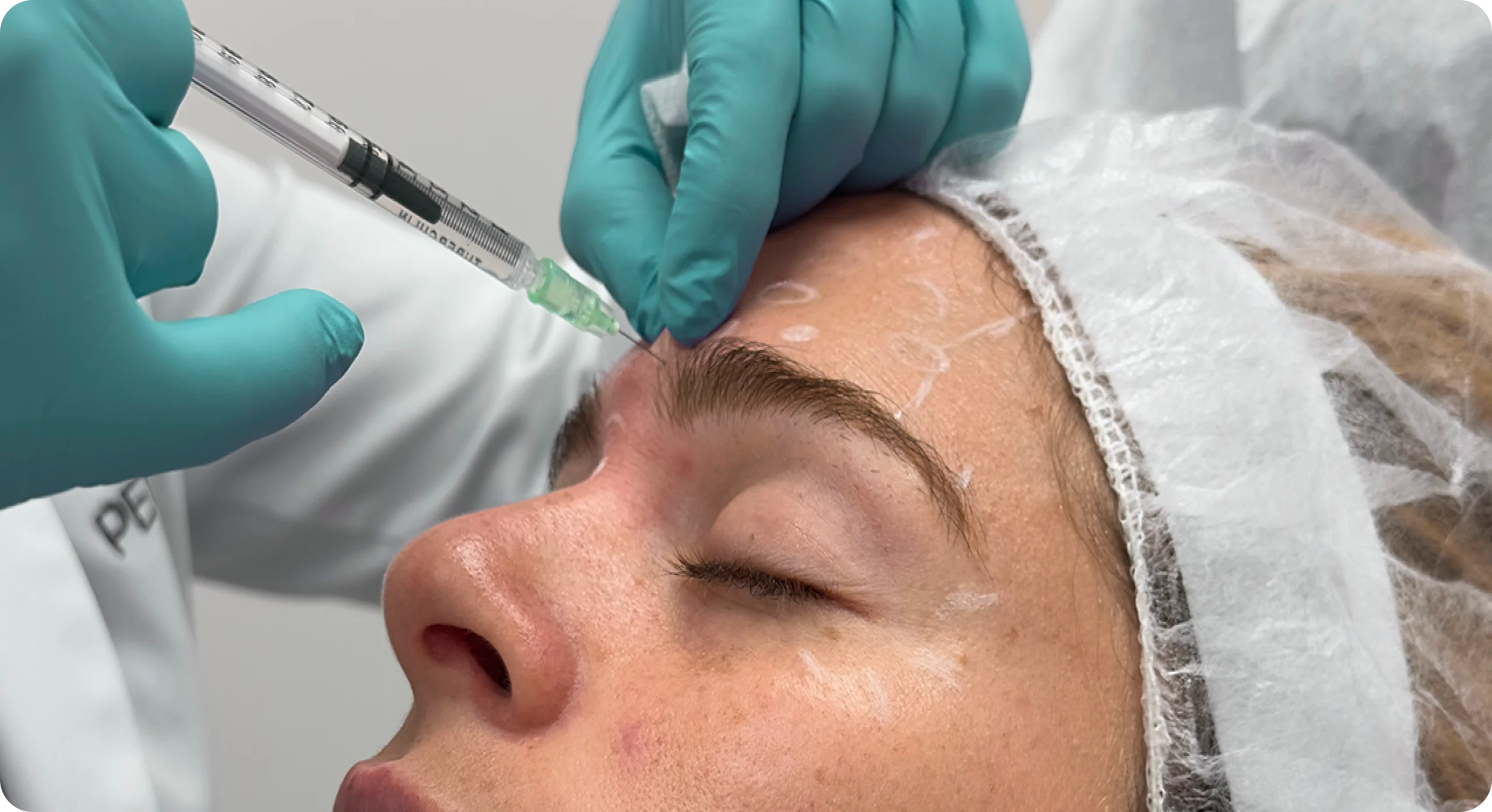 Perfect B - Blog - After Care for Botox - Image 1