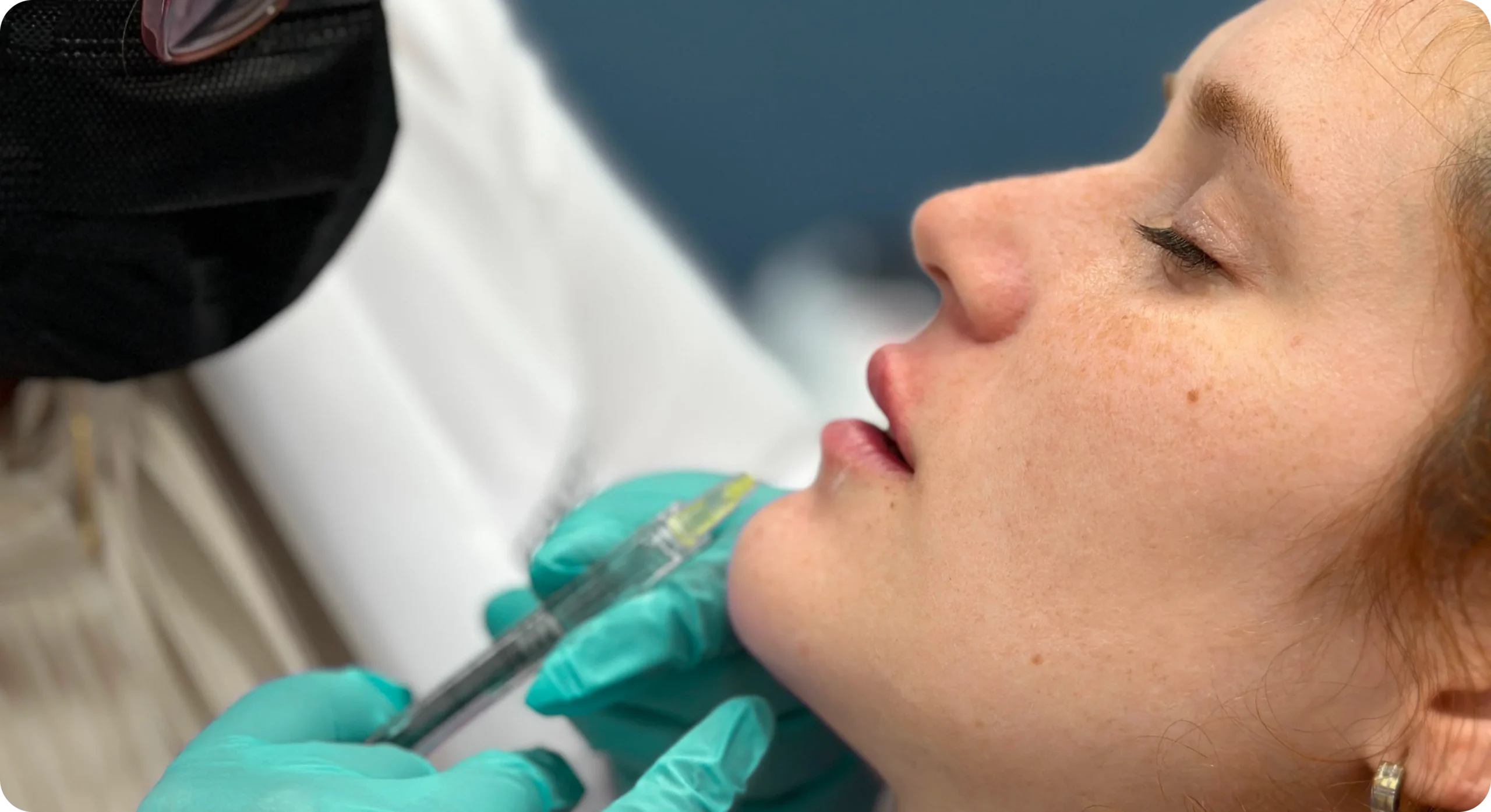 Perfect B - Blog - Botox Lip Flip vs Filler - Image 1