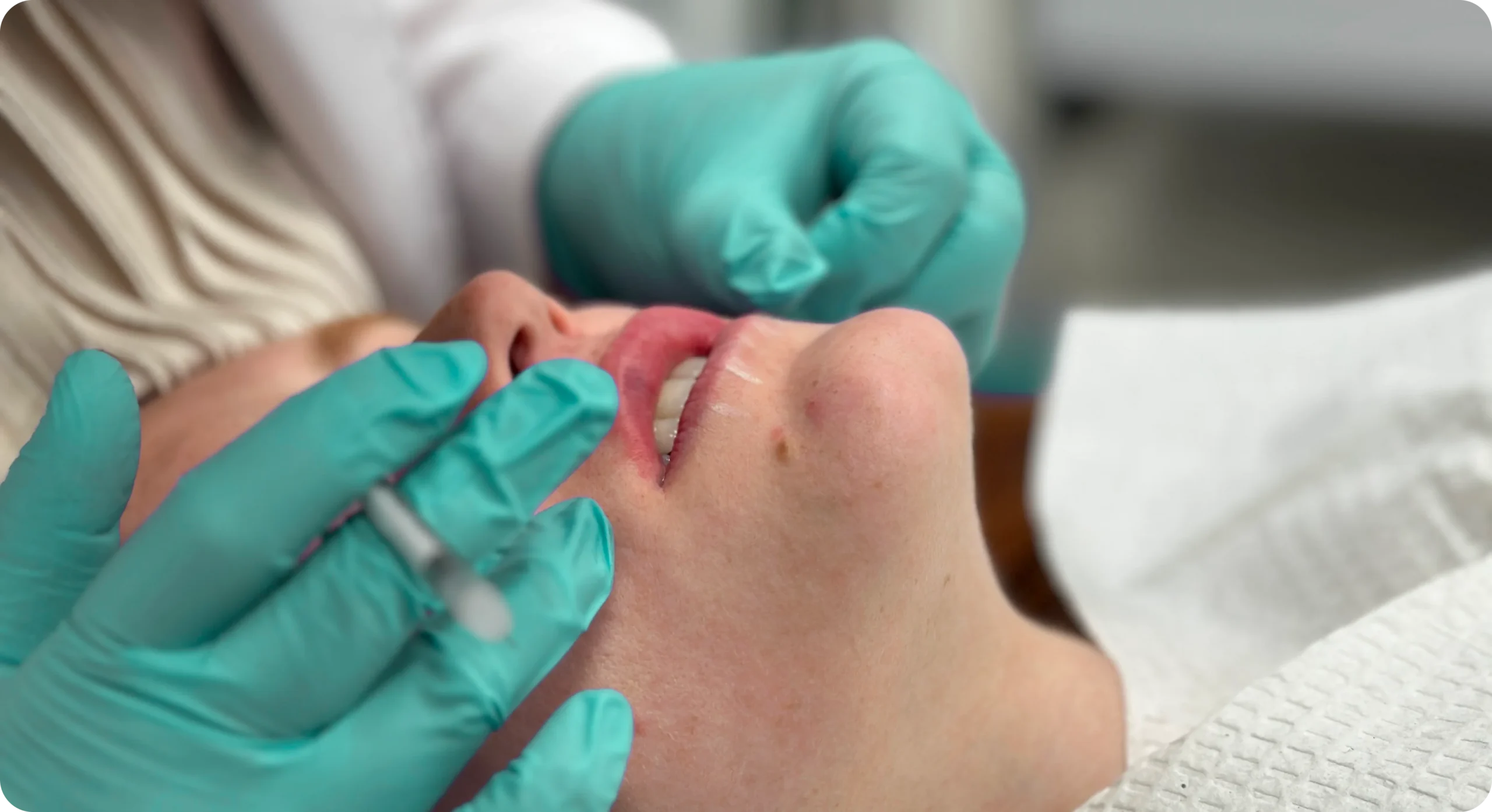 Perfect B - Blog - Botox Lip Flip vs Filler - Image 2