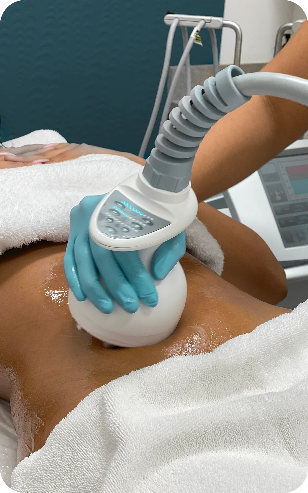 Perfect B - Blog - Cellulite Laser Treatment - Image 1