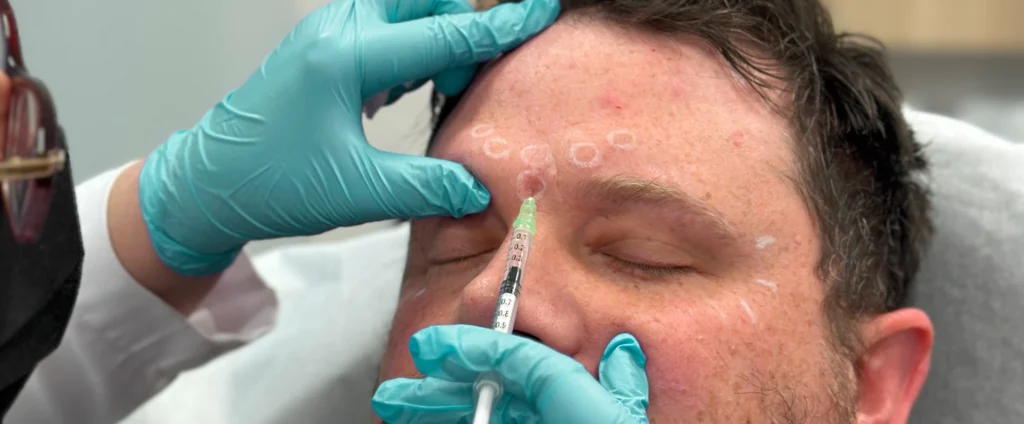 Perfect B - Blog - Forehead Creases - Hero Image