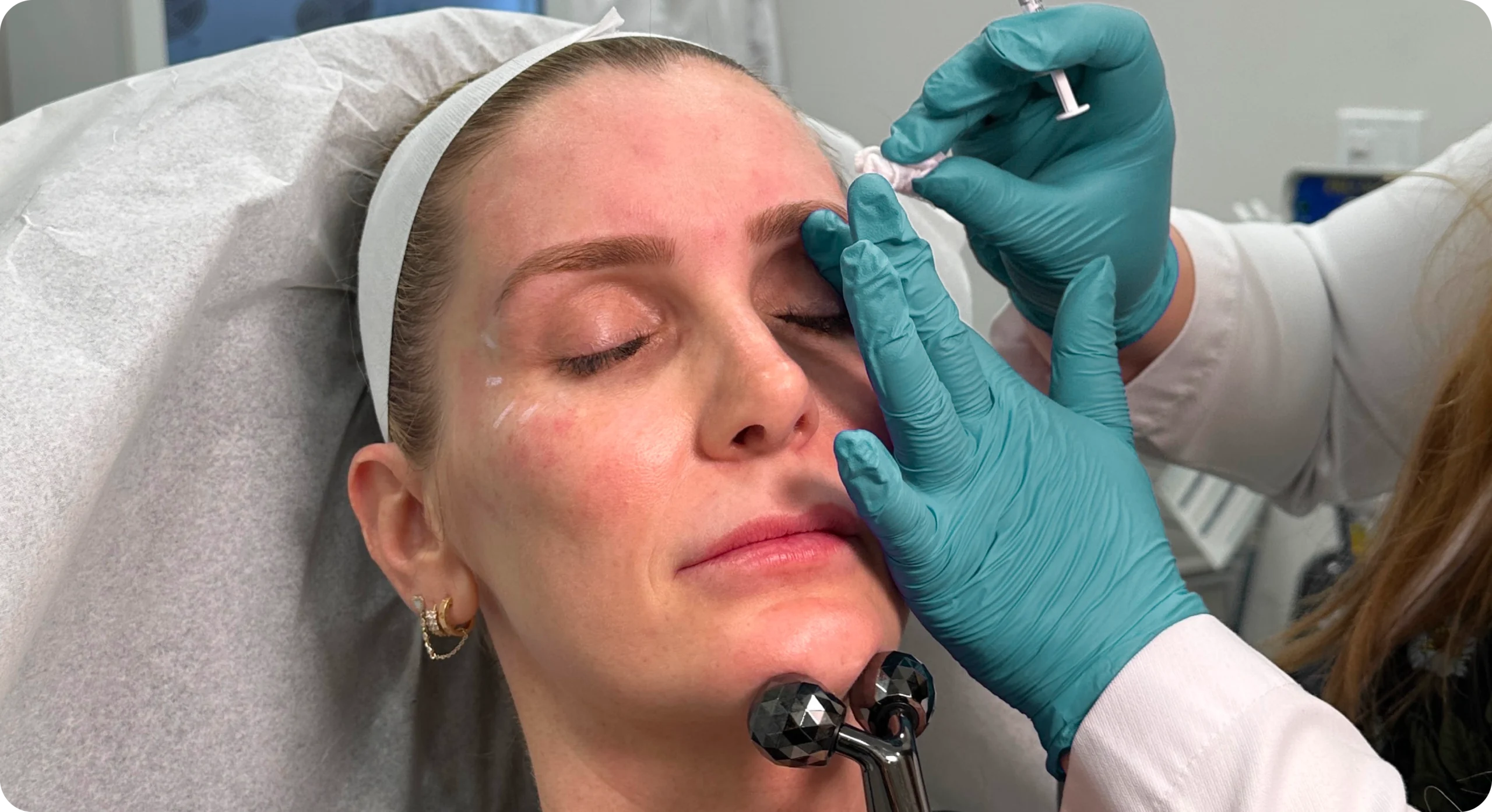 Perfect B - Blog - Forehead Creases -  Image2