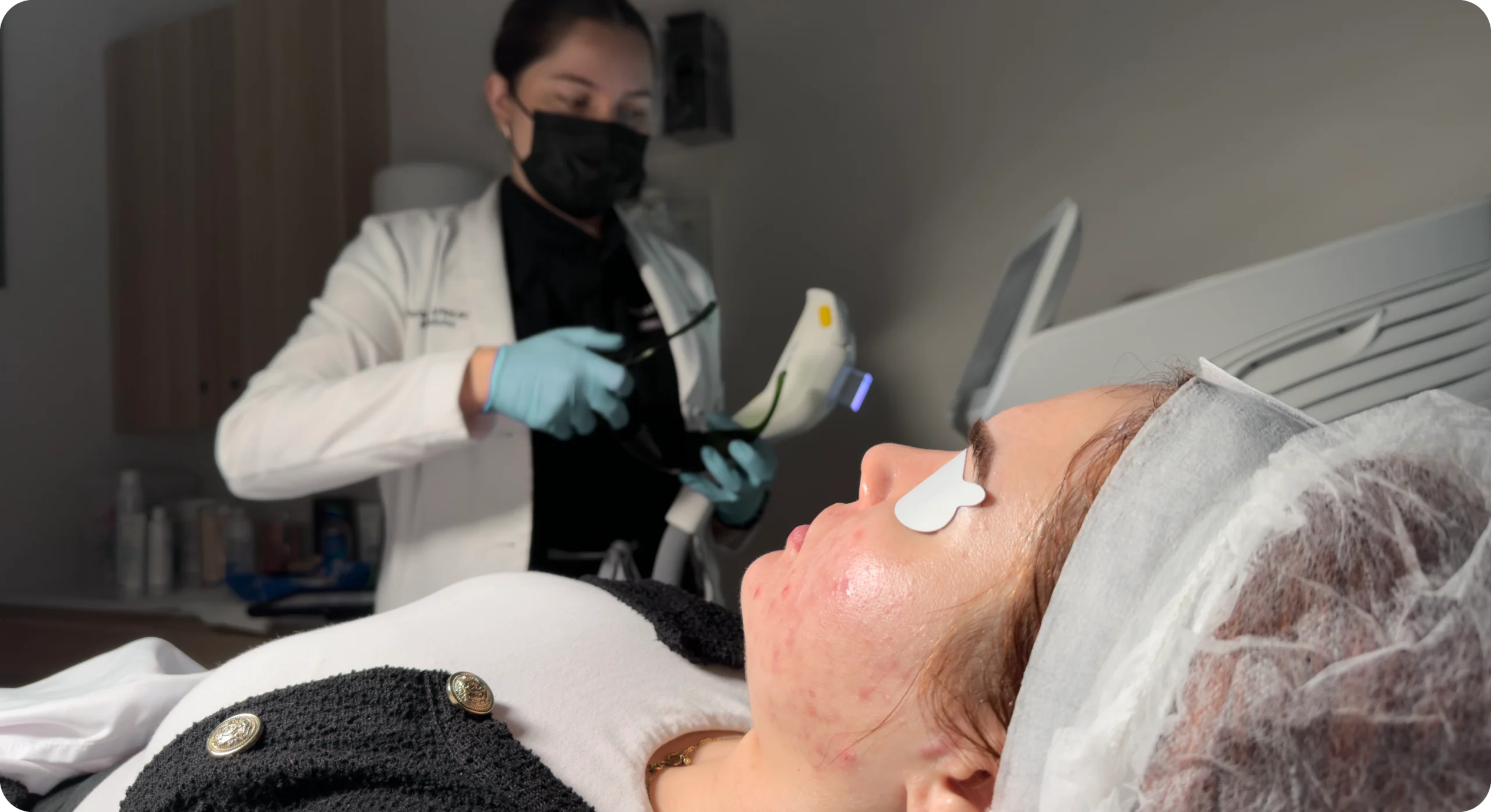 Perfect B - Blog - Acne Scar Removal - IPL preparation