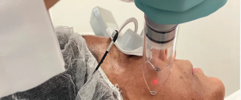 Perfect B - Blog - Tretinoin and Hydroquinone- Image 18