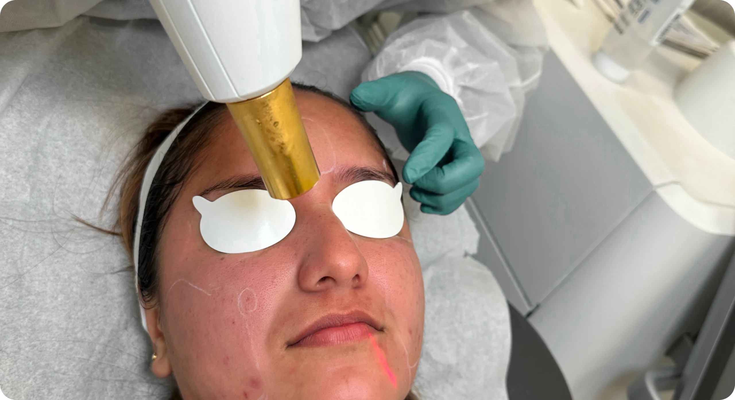 Perfect B - Blog - Tretinoin and Hydroquinone- Image 18