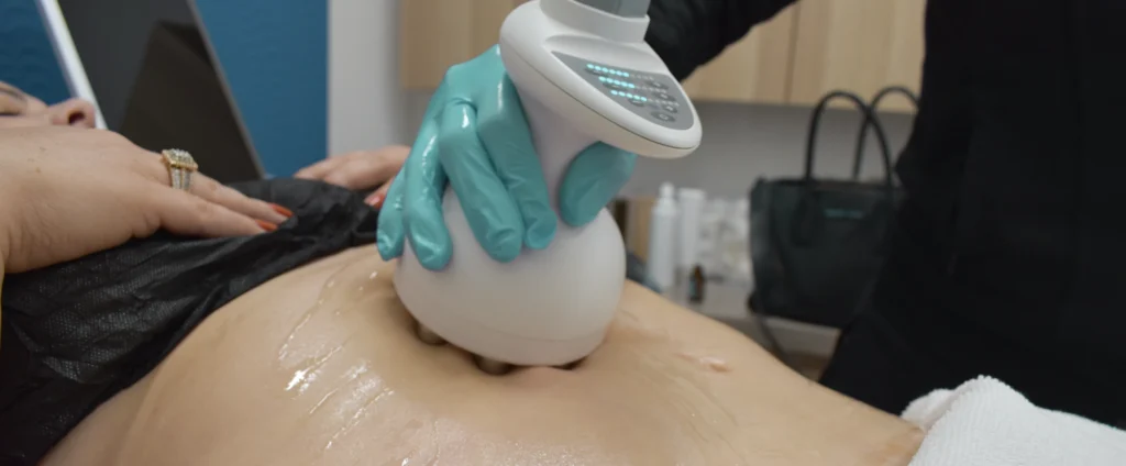 Perfect B - Blog - how to get rid of cellulite - Hero Image