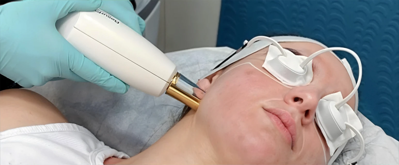 Perfect B - Blog - laser skin tightening - Hero image