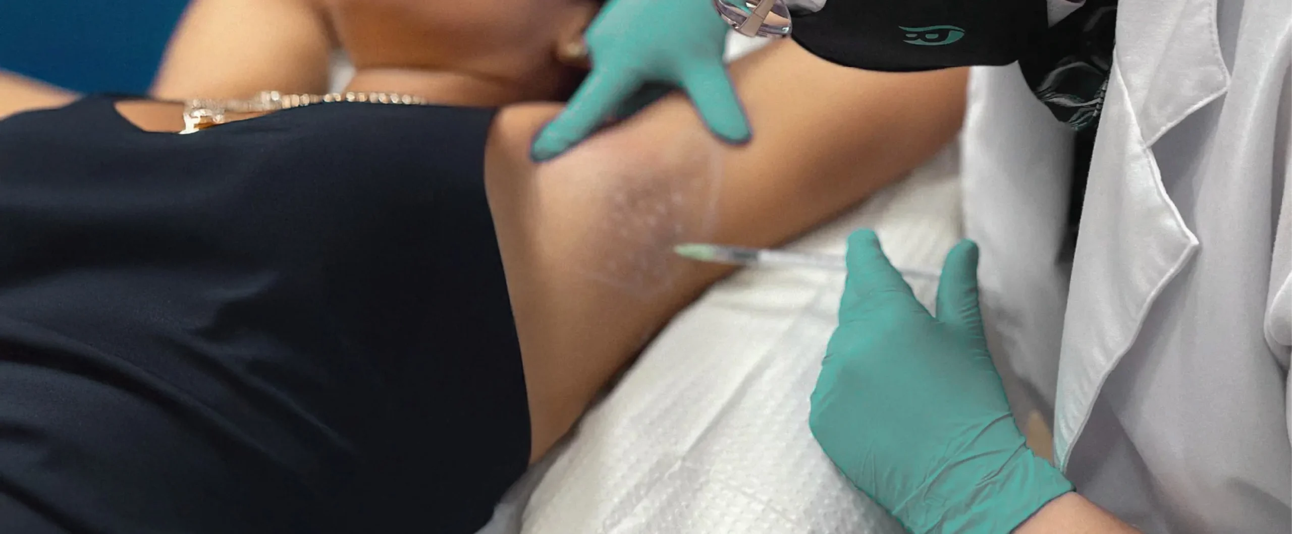 Perfect B - Blog -Botox for Hyperhidrosis- portrait