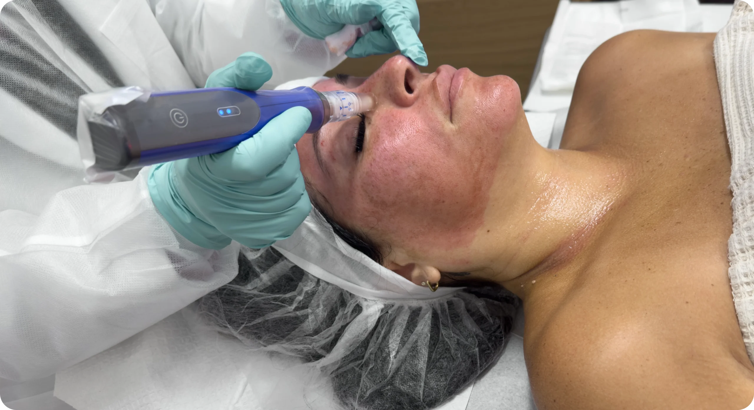 Perfect B - Blog - How to Improve Skin Texture- Image 3