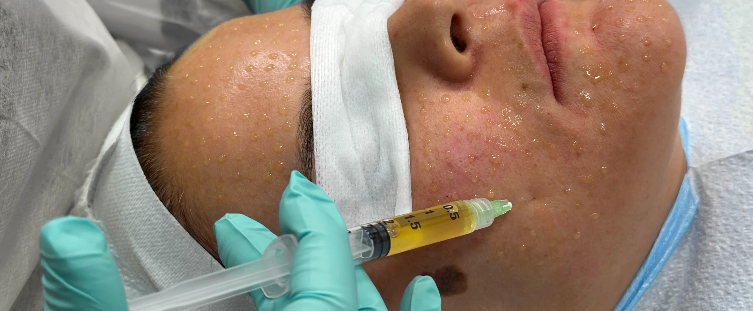 Perfect-B-Blog-How-to-Improve-Skin-Texture-portrait