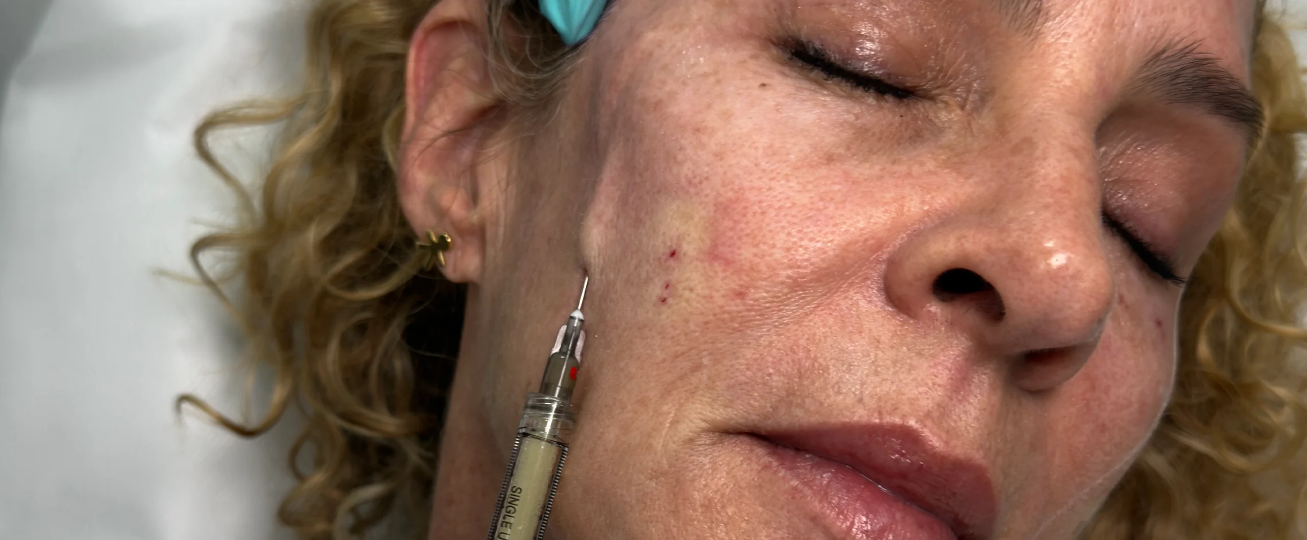 Perfect-B-Blog-Plasma-Gel-for-Under-Eyes-portrait-scaled