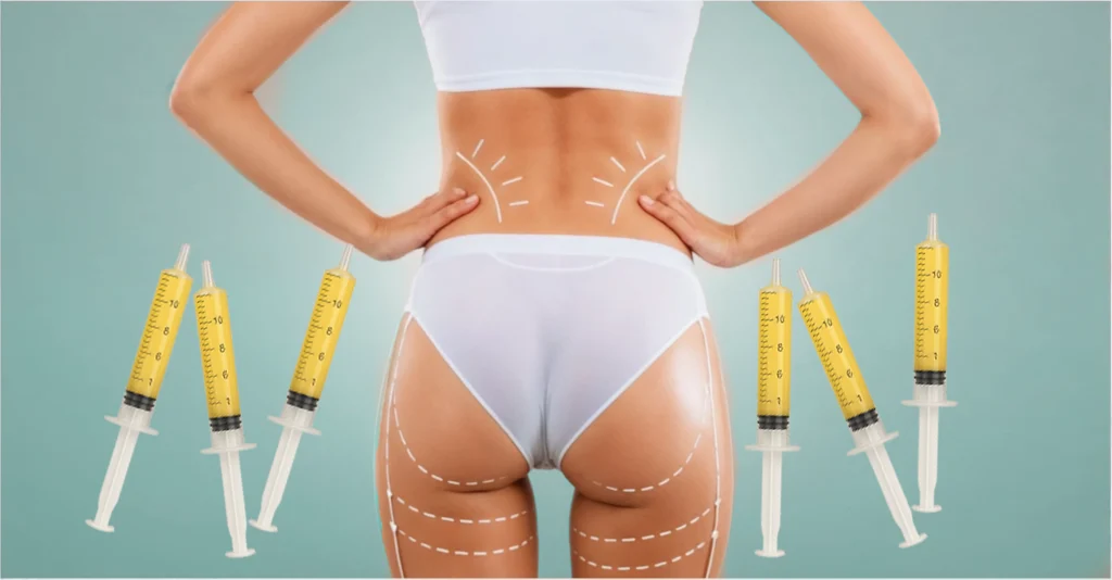 Perfect B - Bum Injection - portrait