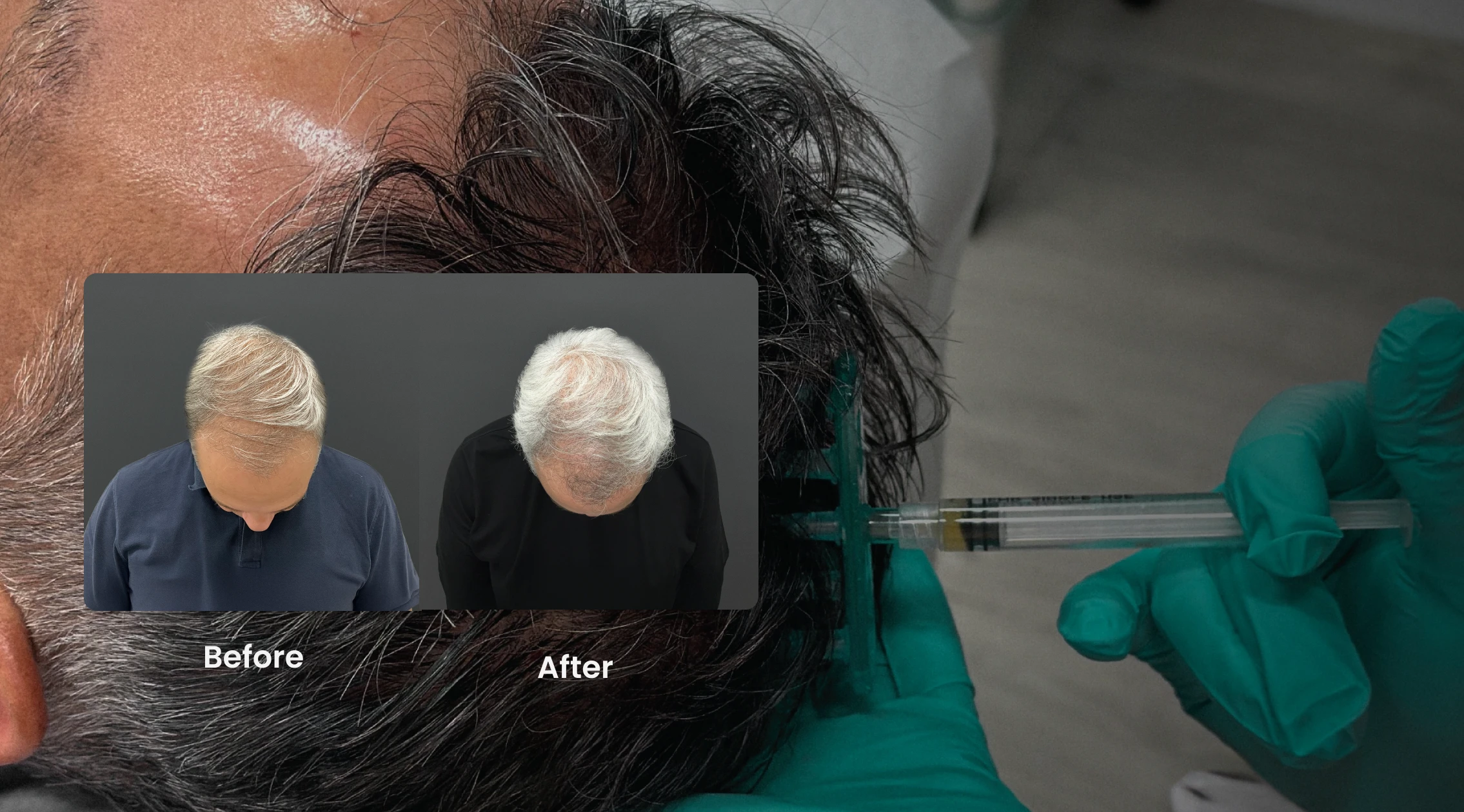 Perfect B - FAQs -Hair Quality Portrait 002